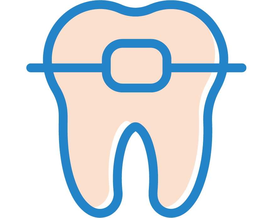 Tooth with wires and bracket for braces