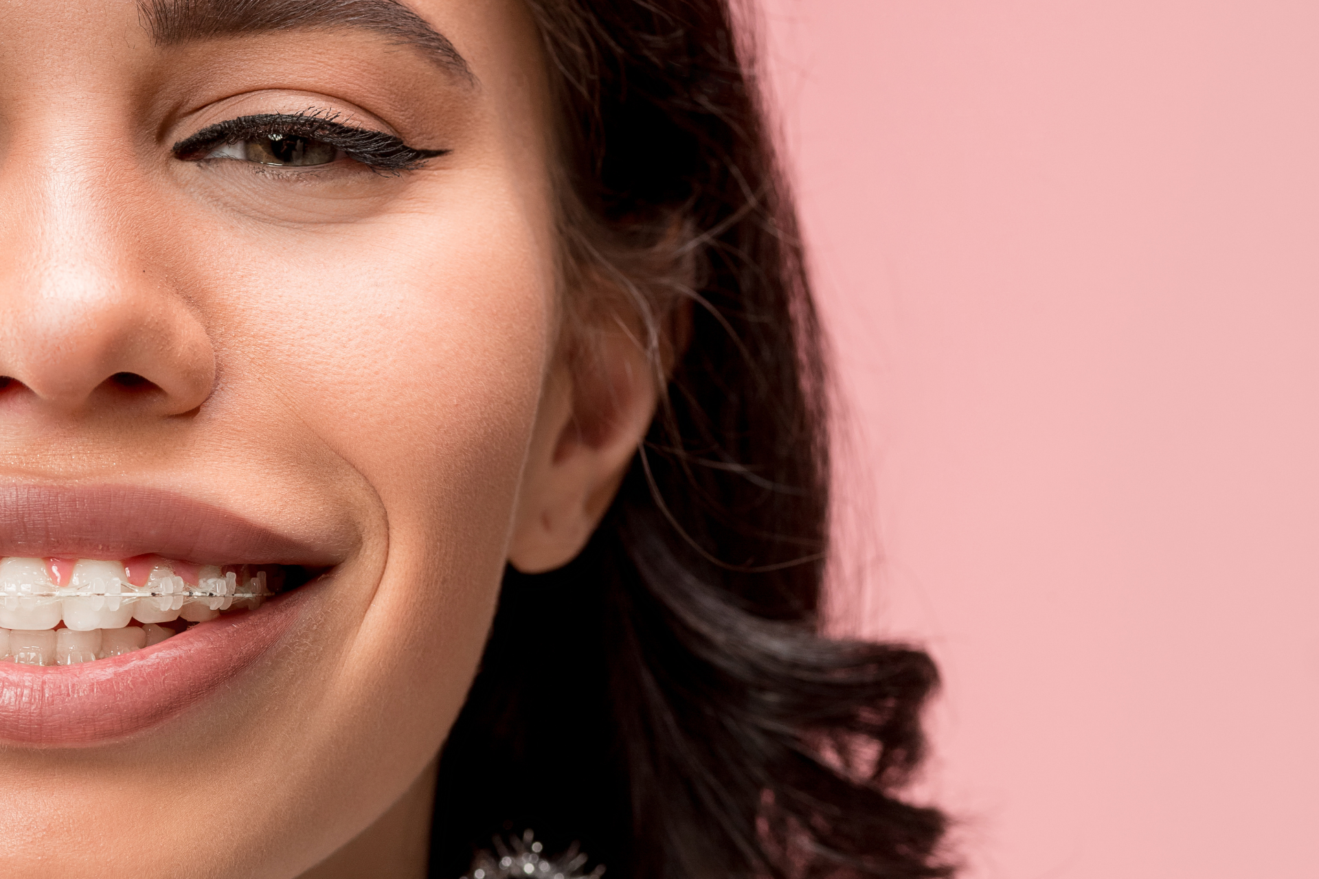 girl with clear braces smiling at camera