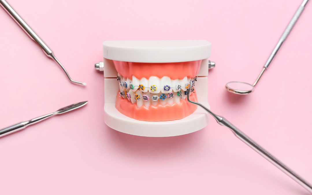 Brace for Impact: Discover the Smile-Altering Magic of Orthodontics