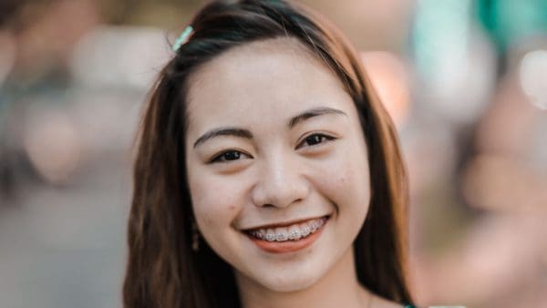Smiling adult woman with metal braces, the kind of case behind how much braces cost