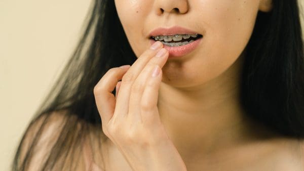Woman with metal braces touching her lip, partway through her adult braces before and after