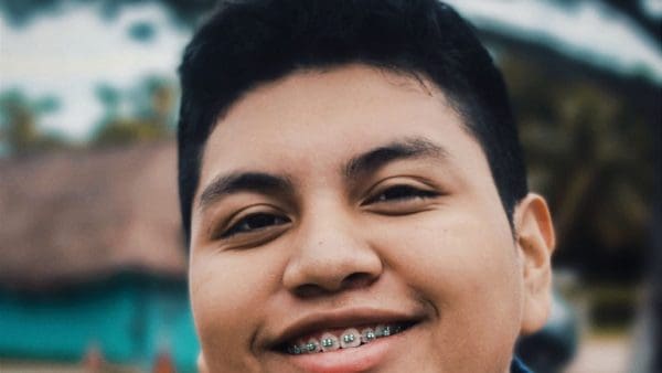 Smiling teen boy with metal braces, the treatment that often closes an open bite