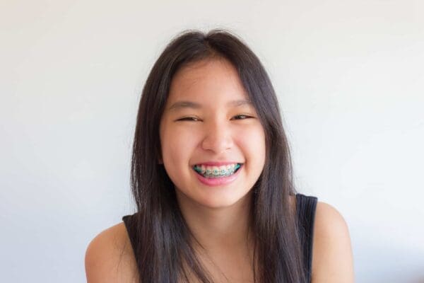 tooth-by-tooth-orthodontics-tooth-by-tooth-dr-patel-teen-girl-teal-braces-big-smile