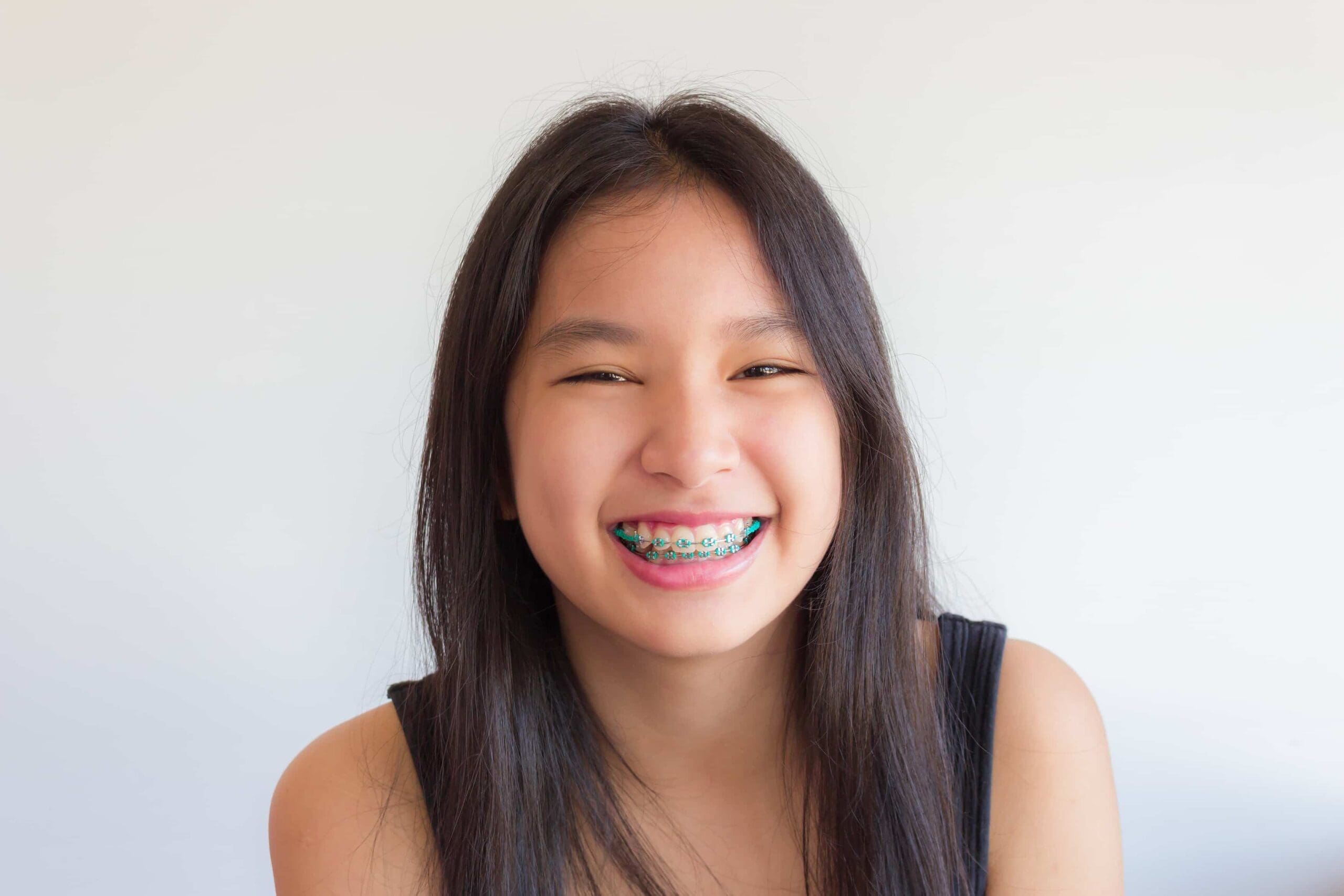 tooth-by-tooth-orthodontics-tooth-by-tooth-dr-patel-teen-girl-teal-braces-big-smile